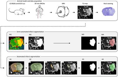 Automated Ischemic Lesion Segmentation in MRI Mouse Brain Data after Transient Middle Cerebral Artery Occlusion